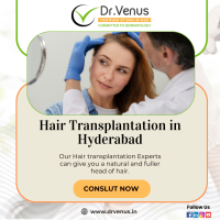 Hair Transplantation in Hyderabad